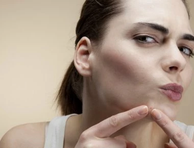 Επτά δερματικές παθήσεις που μοιάζουν με ακμή αλλά δεν είναι (φωτο)